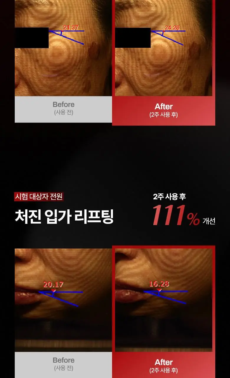 [탄력 리프팅] 메디테라피 링클핏 마스크 7매입 상세페이지 8